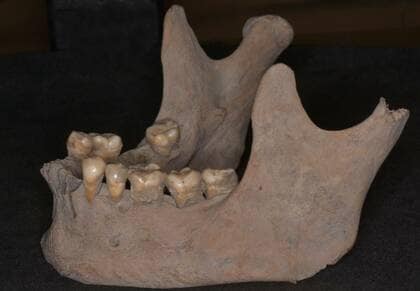 江戸時代も「歯周病」に悩まされていた!? 現代と原因菌に違いも…研究者に当時の“歯磨き”を聞いた