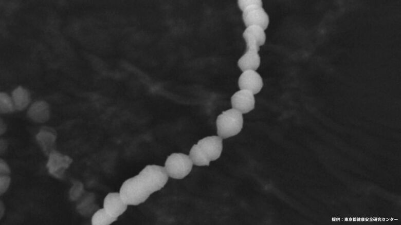溶血性レンサ球菌　提供：東京都健康安全研究センター