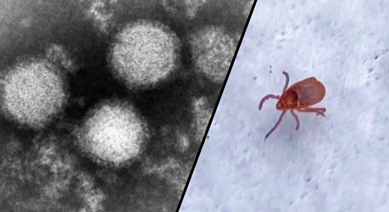 マダニが媒介するSFTSウイルス