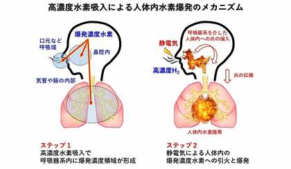 高濃度水素吸入器の着火実験と人体内水素爆発事故｜MiZ・慶應義塾大学 共同研究