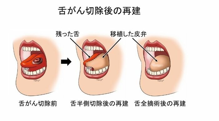出典：国立がん研究センターホームページ