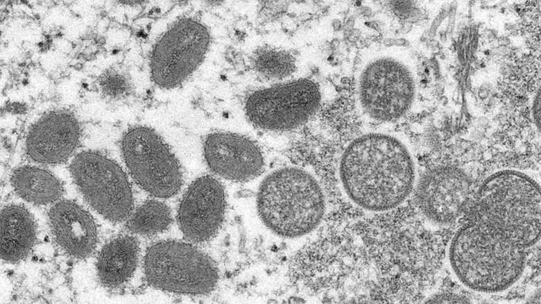【速報】千葉県で「サル痘」感染者が判明　国内4例目　千葉県が緊急会見へ｜FNNプライムオンライン
