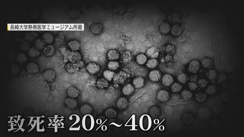 蚊が媒介「日本脳炎ウイルス」 発症後の致死率20～40% 涼しくなり蚊の活動も活発になると要注意｜FNNプライムオンライン
