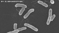【速報】高校生5人が「O157」で入院 長野から沖縄への修学旅行で感染か 生徒と教職員計41人が腹痛、下痢など胃腸炎症状 旅行中の食事を中心に調査
