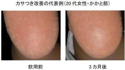 日本メナード化粧品 肌の乾燥に有効な植物素材の組み合わせを発見