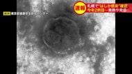【速報】札幌で今年2例目のはしか感染確認＿インドから帰国の50代女性、発熱・発疹で13日に陽性判明…市保健所が予防接種と早期受診を呼びかけ感染拡大に警戒