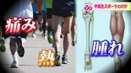 中高の新1年生は要注意…5月に増える“スポーツ外傷”　1回のプレーが原因で肉離れや靱帯損傷も　いますぐ自宅でできる予防法を紹介