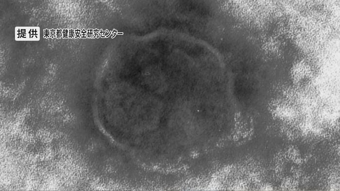 提供:東京都健康安全研究センター