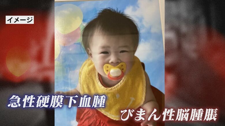 死因は急性硬膜下血腫とびまん性脳腫脹