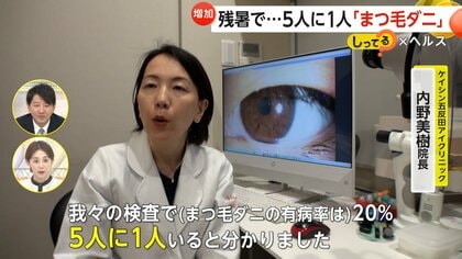 まつ毛 人気 ダニ 眼科 大阪