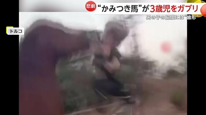 少年が馬にかみつかれた瞬間(IHA)