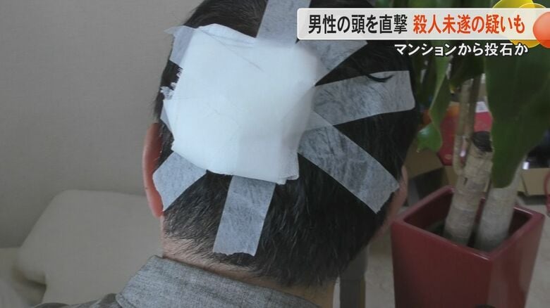 【続報】「血まみれになって倒れた」熊本市中央区のマンションで何者かが石落としたか　頭に直撃した男性に単独インタビュー｜FNNプライムオンライン