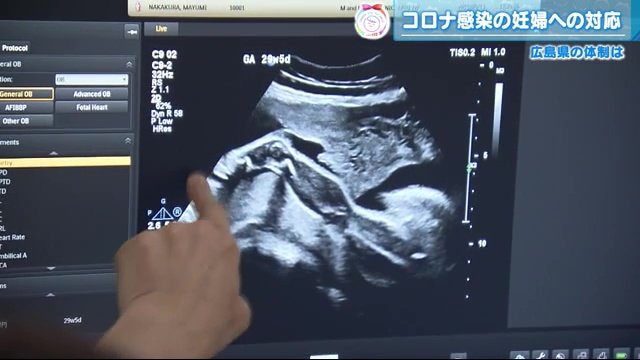 妊婦が感染した場合のリスクは…