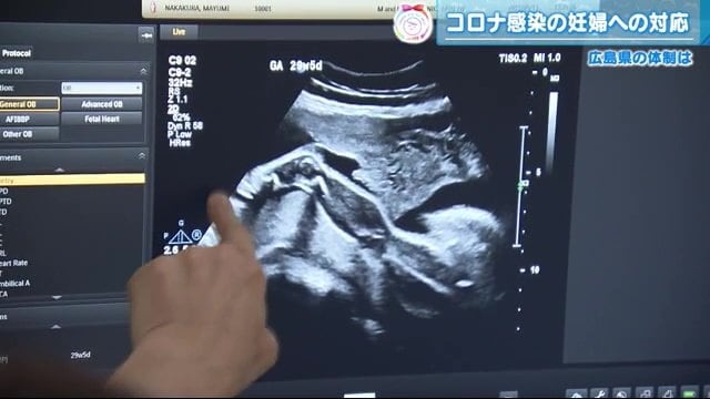 妊婦が感染した場合のリスクは…