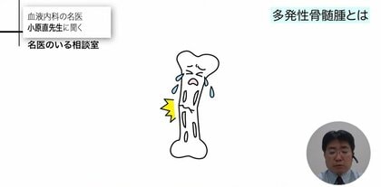 完治が難しい血液のがん「多発性骨髄腫」初期症状がないことが多くコロナ重症化も…最新の治療法と予防法を解説