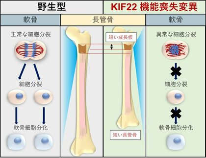 関節弛緩を伴う脊椎骨端骨幹端異形成症2型の責任遺伝子KIF22の機能を解明 ~難病の病因解明に一歩前進~