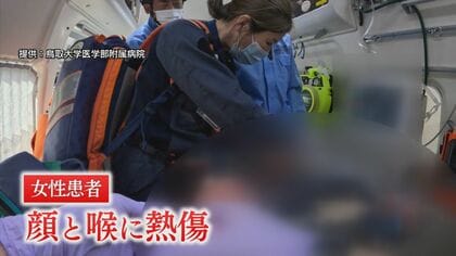 火傷の高齢女性の治療にあたる松尾医師