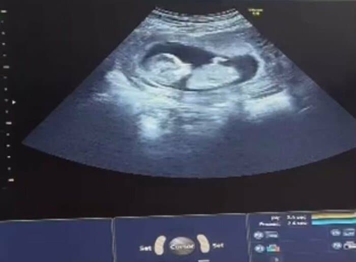 「我が子」のエコー