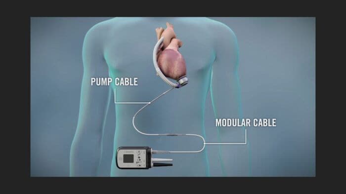 提供：アボットメディカルジャパン