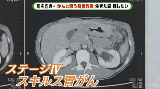 CT画像