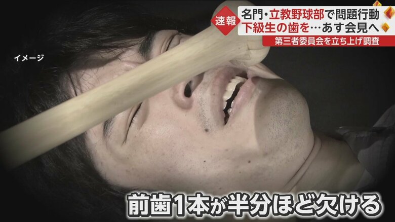 【イメージ3/3】前歯が折れた原因は“額を狙ってバットを倒す”行為