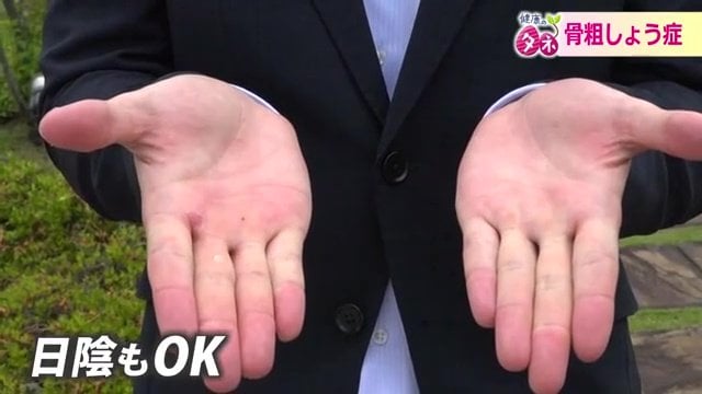1日15分は手のひらで日光浴を