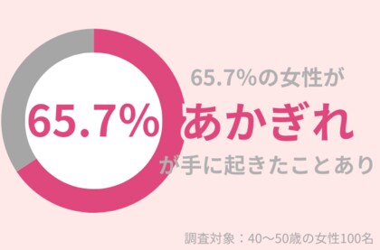 65.7%の40代女性が手に「あかぎれ」が起きたことがある:効果的なケアで予防・改善を目指す!