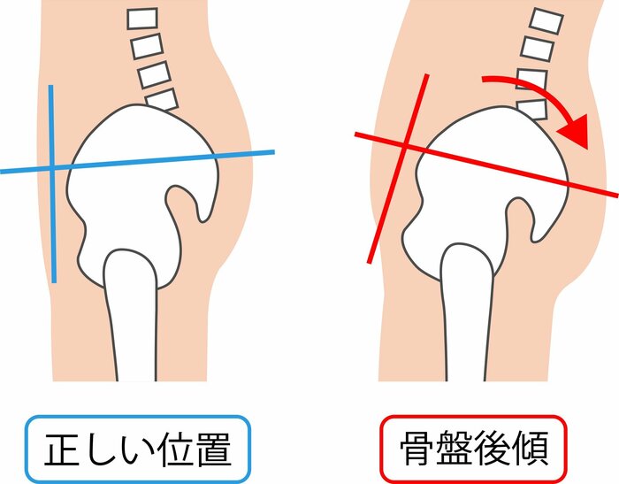 （画像はイメージ）