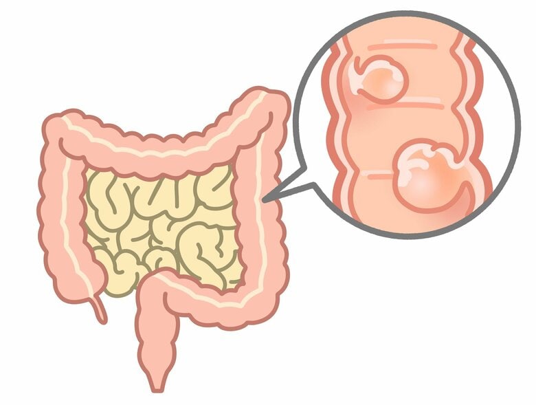（画像はイメージ）