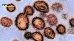 クラスター発生のいわき市や郡山市を中心に福島県内で新たに11人が新型コロナ感染<4月12日発表>