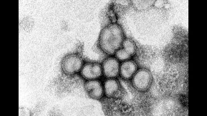 北海道でインフルエンザが再び流行 今シーズン2回目の”警報”発表…今度は「B型」 一度かかっていても油断は禁物 2度目の感染も