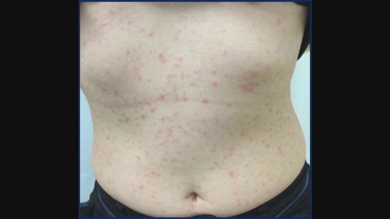 提供：日本性感染症学会