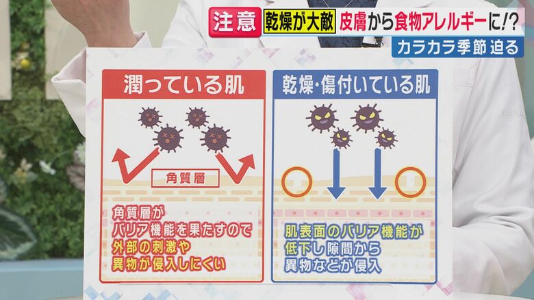 乾燥して傷ついた皮膚には“要注意”（関西テレビ「旬感LIVE とれたてっ！」より）