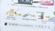 血液検査で乳がんの早期発見へ 那覇市で臨床検査開始
