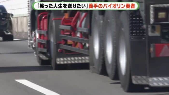 看護学生だった20歳の頃、交通事故で右腕を失う