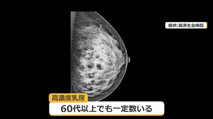 乳腺が多い「高濃度乳房」は発見しづらいことも