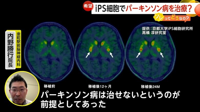 パーキンソン病に詳しい金町駅前脳神経内科・内野勝行院長