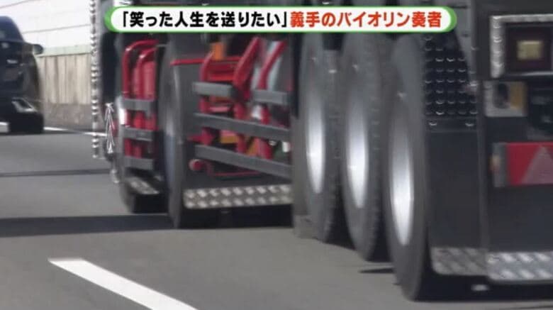 看護学生だった20歳の頃、交通事故で右腕を失う