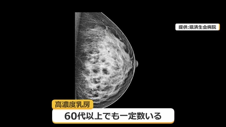 乳腺が多い「高濃度乳房」は発見しづらいことも