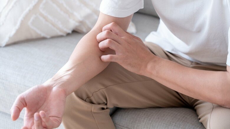 悩みを乗り越え“なりたい自分”になるために。アトピー性皮膚炎の「つらい」を変える将来設計型ワークショップ｜FNNプライムオンライン