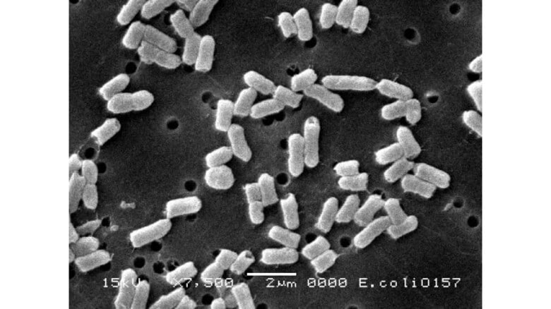 島根県内で2025年初確認　腸管出血性大腸菌に感染し20代男性が下痢や腹痛などの症状訴え一時入院｜FNNプライムオンライン