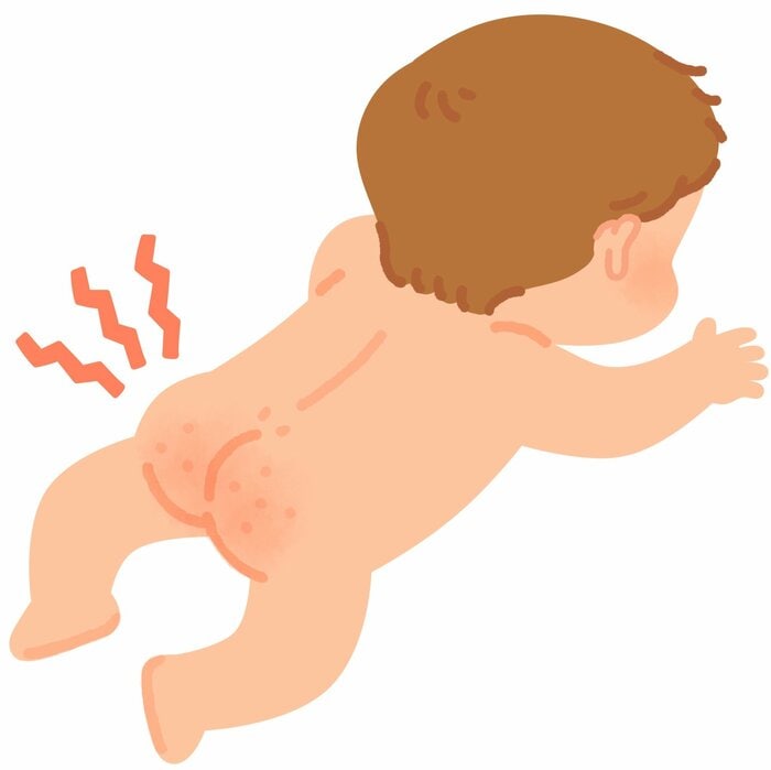 水が使えないような災害時は赤ちゃんの肌トラブルも増える（画像はイメージ）