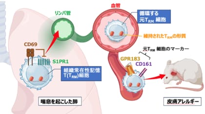 組織常在性T細胞が“炎症記憶”を保持し全身へ波及 ～全身に連鎖するアレルギー疾患の新たな治療法開発に光～