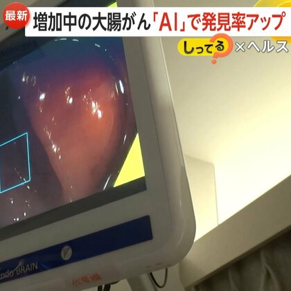がん発見率が“7〜10％向上”…増加中の大腸がん発見する「内視鏡AI」　40歳から内視鏡検査を推奨…検査費は保険適用に【しってる？】