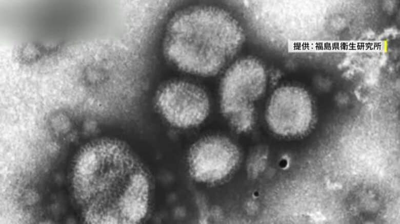 《福島県》インフルエンザ注意報　去年より1カ月早い発表　11月2日までの感染者・学級閉鎖が増加｜FNNプライムオンライン