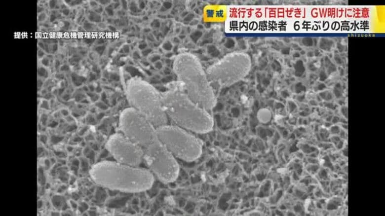 さらなる感染拡大の懸念も…6年ぶりの高水準「百日ぜき」に注意｜FNNプライムオンライン