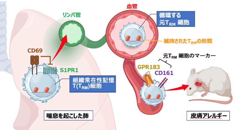 組織常在性T細胞が“炎症記憶”を保持し全身へ波及 ～全身に連鎖するアレルギー疾患の新たな治療法開発に光～