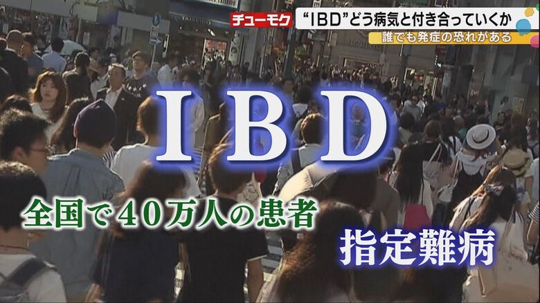 安倍元首相も患っていた指定難病『IBD』職場の理解得られず退職したケースも…認知度1割という病気を知ってほしいと願い活動する金沢の医師に密着｜FNNプライムオンライン