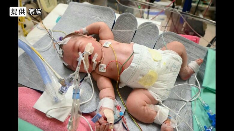 別の病院で入院時（提供：家族）