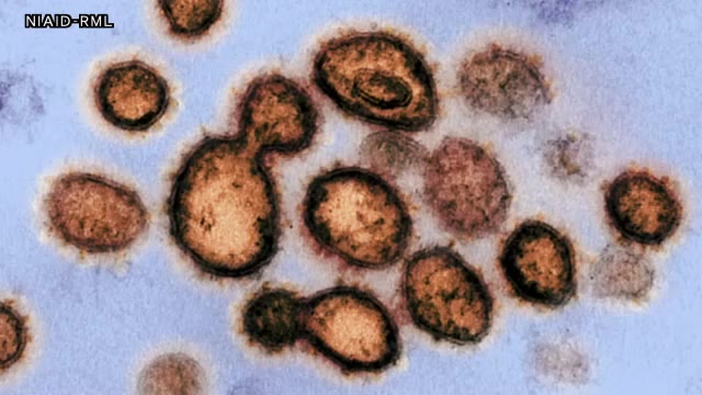 札幌市新たに7人…クラスター発生の病院3人とライブハウスも確認 北海道感染者は計11人 5日連続2桁